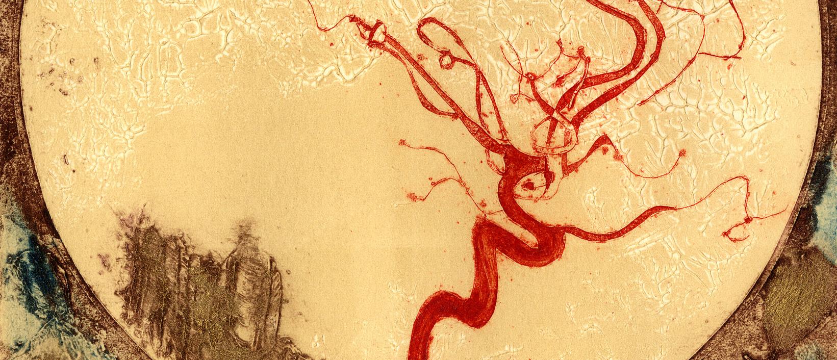 Between a Thing and a Thought, artwork by Susan Aldworth