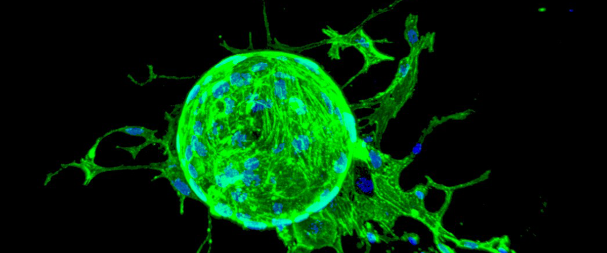 Endothelial cell-coated beads encapsulated within FN-PEG hydrogels in order to study the pro-angiogenic activity (EC sprouting) of the system when supplementing the media with VEGF. Endothelial cells are activated upon VEGF signals and migrate accordingly in the appropriate environment. Image by Sara Trujillo-Muñoz