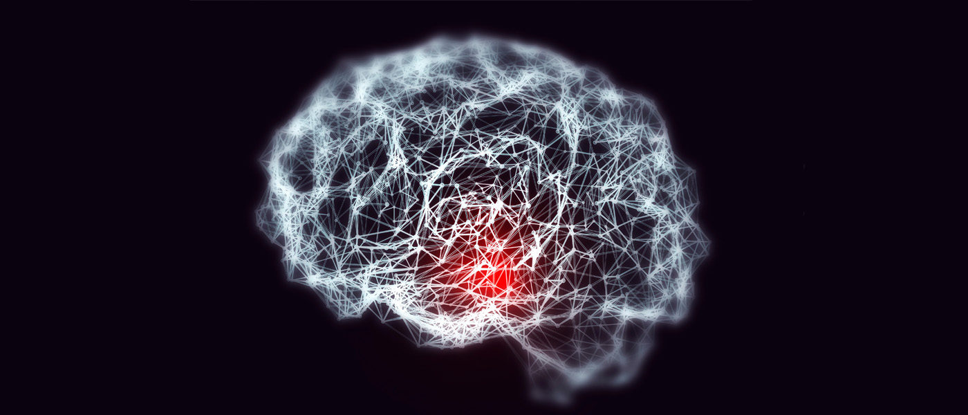 Dementia and Alzheimer's disease medical concept of a brain