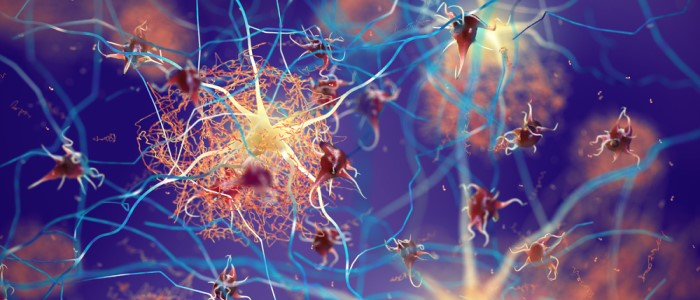 Beta-amyloid protein disrupting nerve cells function in a brain with Alzheimer's disease